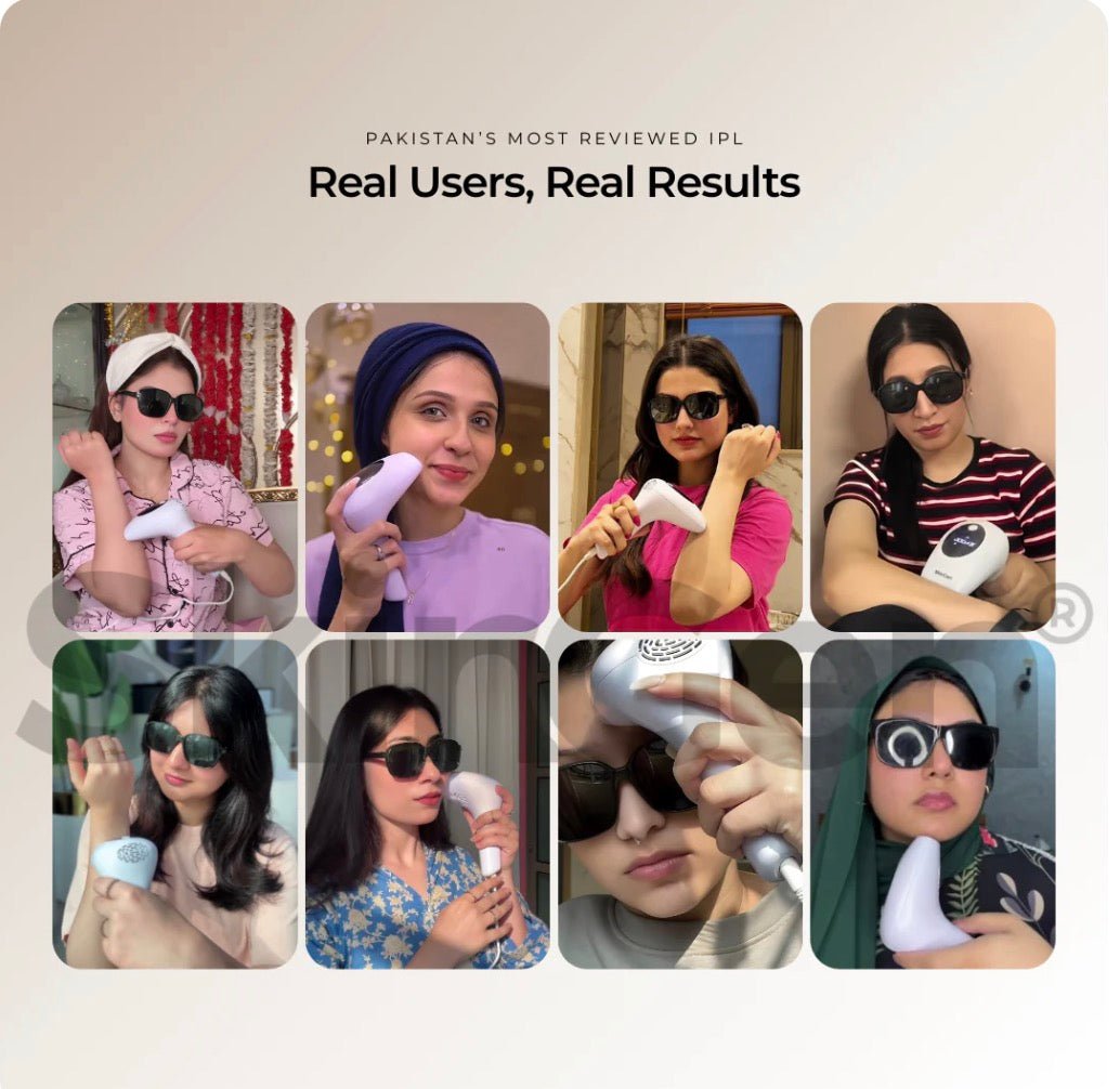 Laser Hair removal device - Montè - Montè