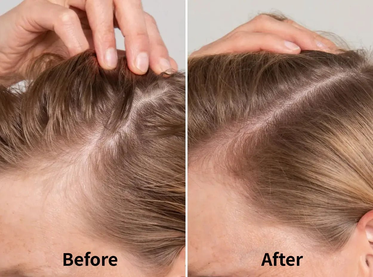 Scalp Massage comb - Montè™ - Montè